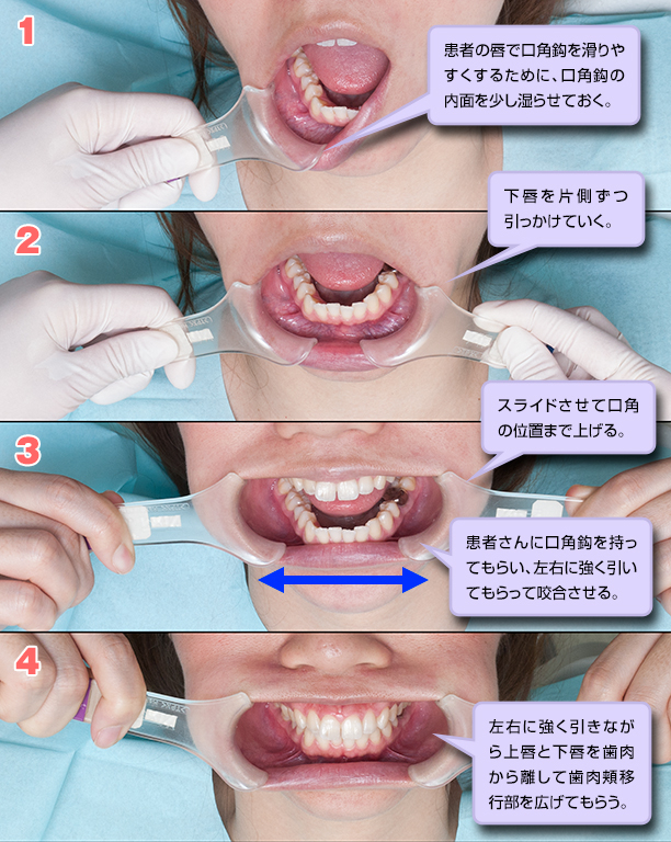 歯科口腔内写真 【Nikonダブルスロット】使用詳細マニュアル付